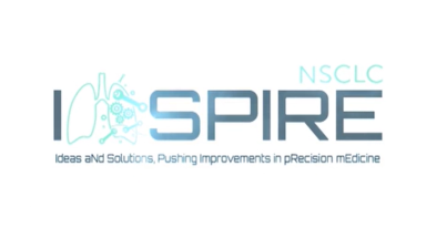 Malaysia Region Treatment stratergy with EGFR-TKIs Asian setting 