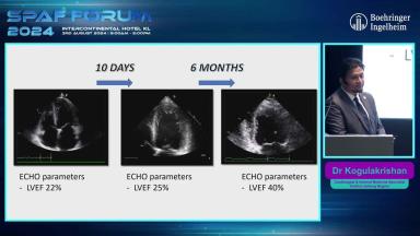 Atrial Fibrillation & Heart Failure